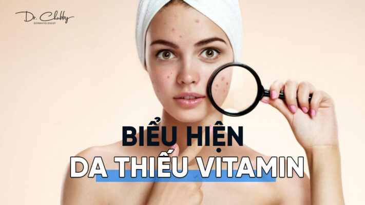 Bieu hien cua da khi thieu Vitamin