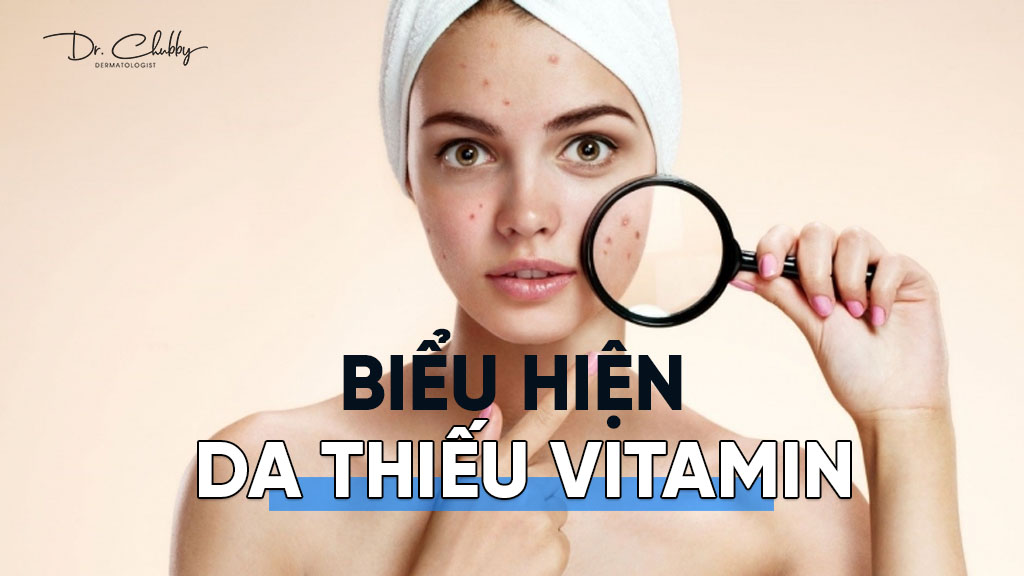 Bieu hien cua da khi thieu Vitamin