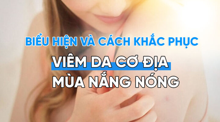 Bieu hien va cach khac phuc viem da co dia mua nang nong