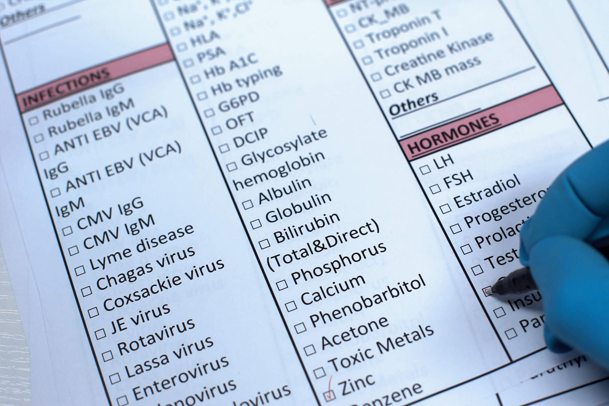 Co nhung phuong phap xet nghiem noi tiet nao