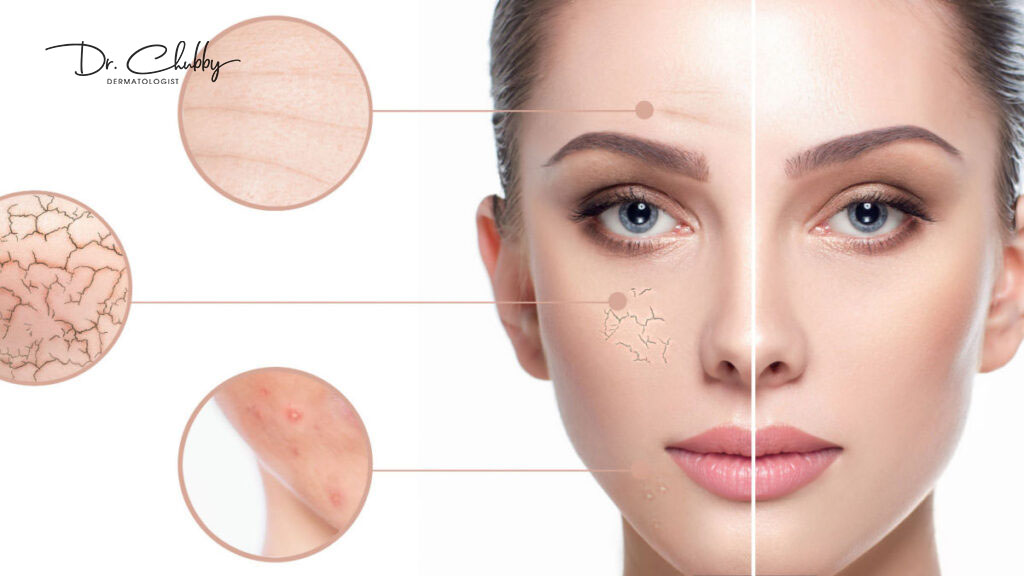 SU THAT VE THU NHO LO CHAN LONG