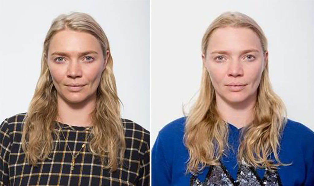 Ngủ sai tư thế hình thành nếp nhăn ngủ Sleep wrinkles