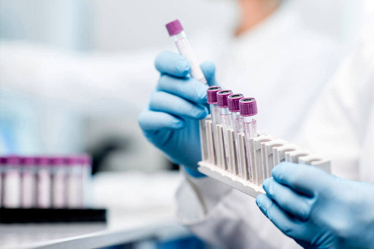 Vi sao xet nghiem noi tiet lai quan trong