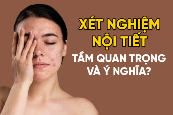 Xet nghiem noi tiet