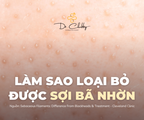 Sợi bã nhờn và những điều cần biết Sợi bã nhờn và những điều cần biết