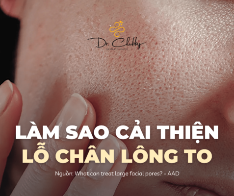 LỖ CHÂN LÔNG TO: NGUYÊN NHÂN VÀ CÁCH KHẮC PHỤC