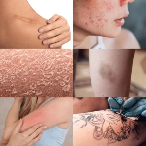 Kem dưỡng phục hồi da DermEden Specific Protocole Cicaderm Repair Care (30ml) cica 1