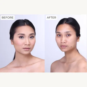 Lotion 2 in 1 làm sạch và tẩy trang DermEden Complete Cleanser Milk Lotion 150ml