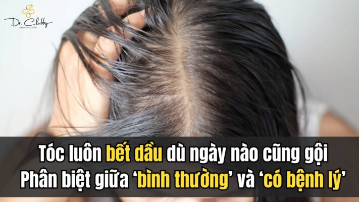 tóc bết dầu dù mới gội đầu