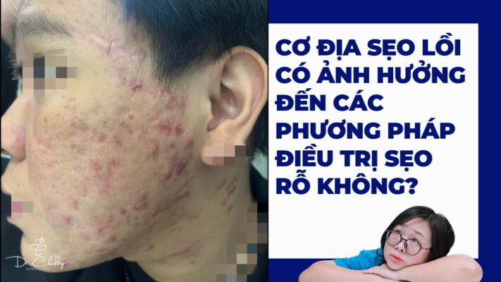 Trị sẹo rỗ cho da cơ địa sẹo lồi