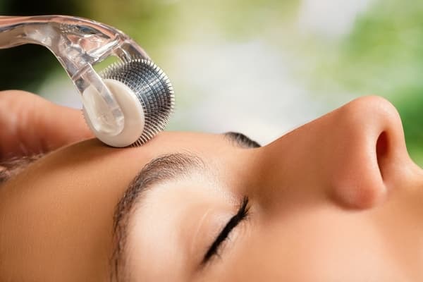 Cơ Địa Sẹo Lồi Có Trị Sẹo Rỗ Được Không? Chuyên Gia Giải Đáp phương pháp lăn kim