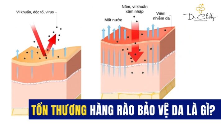 tổn thương hàng rào bảo vệ da
