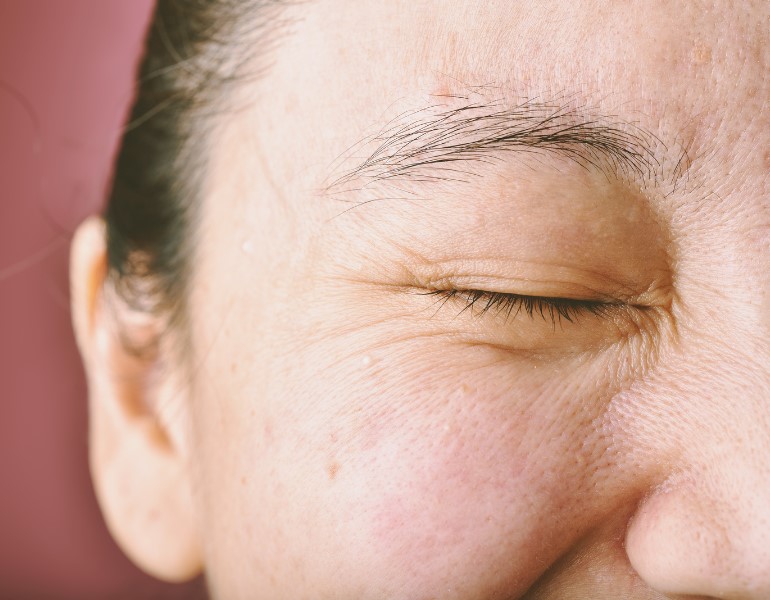 da khô xuất hiện nếp nhăn sớm hơn