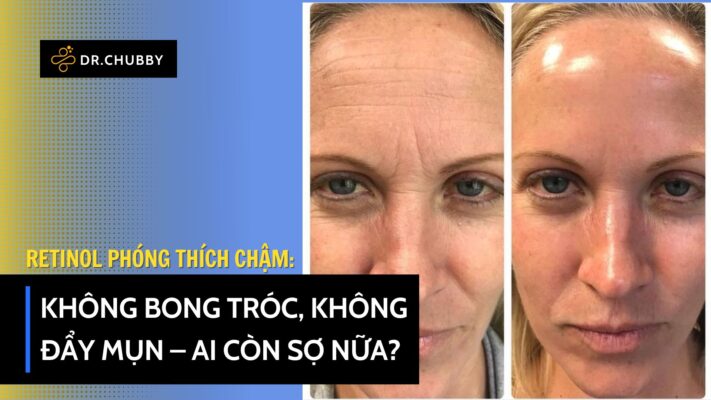 Thời Đại 5.0 – Retinol Phóng Thích Chậm: Không Bong Tróc, Không Đẩy Mụn!