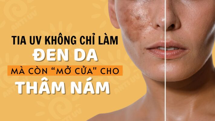 Nguyên Nhân Gây Nám Da Ngoài Tia UV: Cách Chống Nắng Đúng & Trị Nám Hiệu Quả