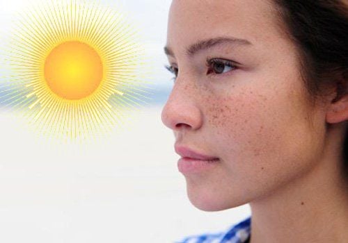 da thường xuyên tiếp xúc với ánh mặt trời